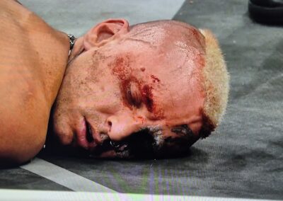 Darby Allin has a bad evening on Dynamite