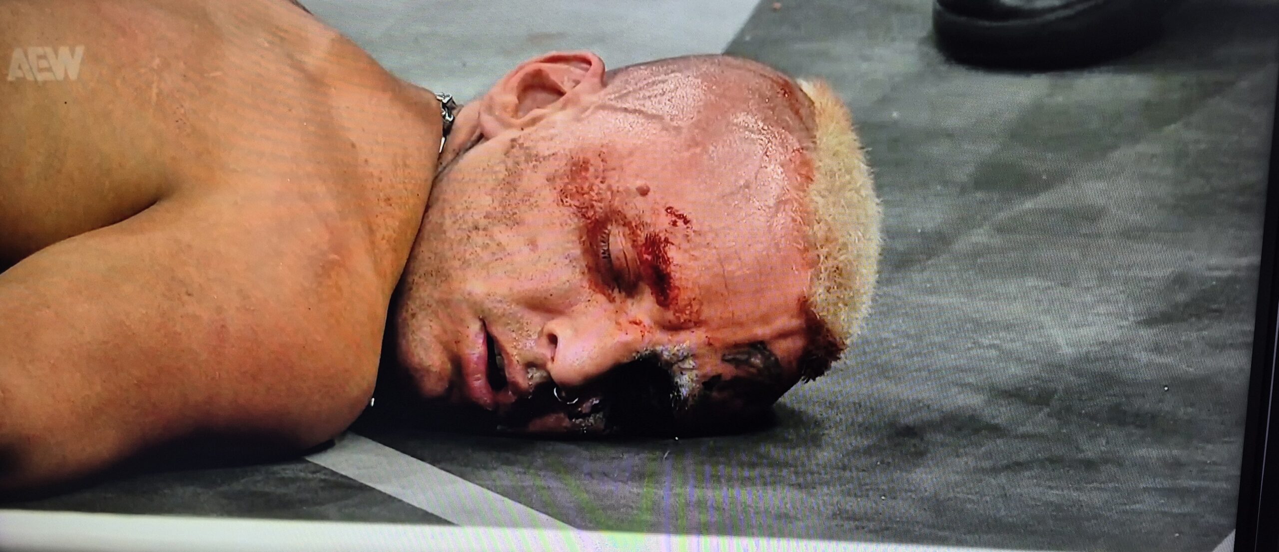 Darby Allin has a bad evening on Dynamite